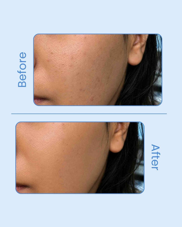 Pure Sea - Radiance Boosting Gel Face Wash