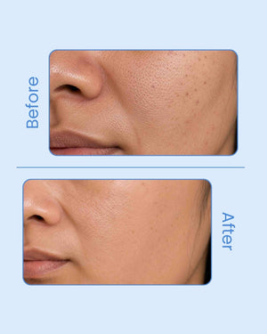 NARRA Dew Radiance – brightening marine serum for dull, uneven skin tone