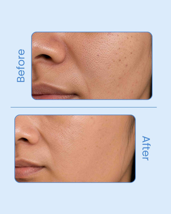 NARRA Dew Radiance – brightening marine serum for dull, uneven skin tone