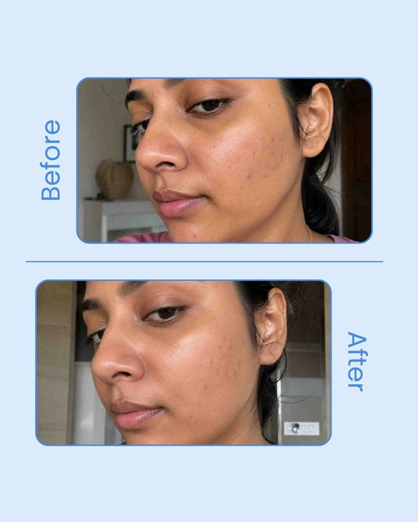 sunscreen-spf50.jpg	NARRA Ultimate Marine – broad spectrum SPF 50 PA++++ sunscreen for Indian skin, non-greasy finish